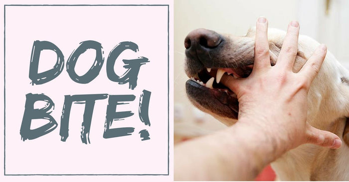 How To Prevent Dog Bite